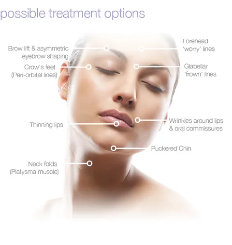 Diagram of possible treatment areas: forehead and frown lines, crow's feet, brow, lips, chin and neck